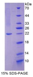 SDS-PAGE (NOS2-7795H).jpg